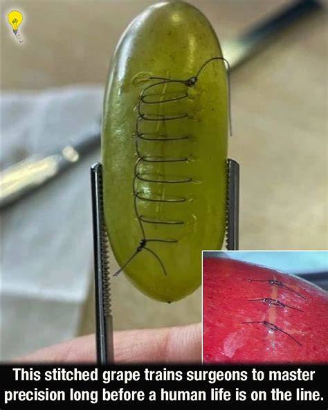 grape-stitches-video